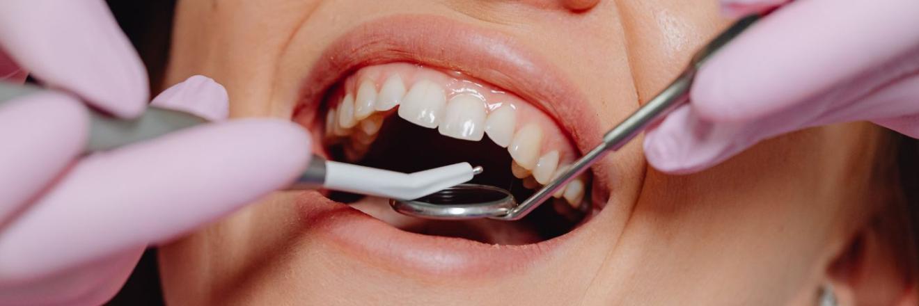 Cover image for fixedpricedental