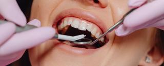 Cover image for fixedpricedental